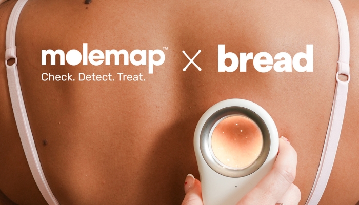 [Agency Appointment] Molemap x Bread